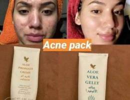 Aloe vera gel and acne cream